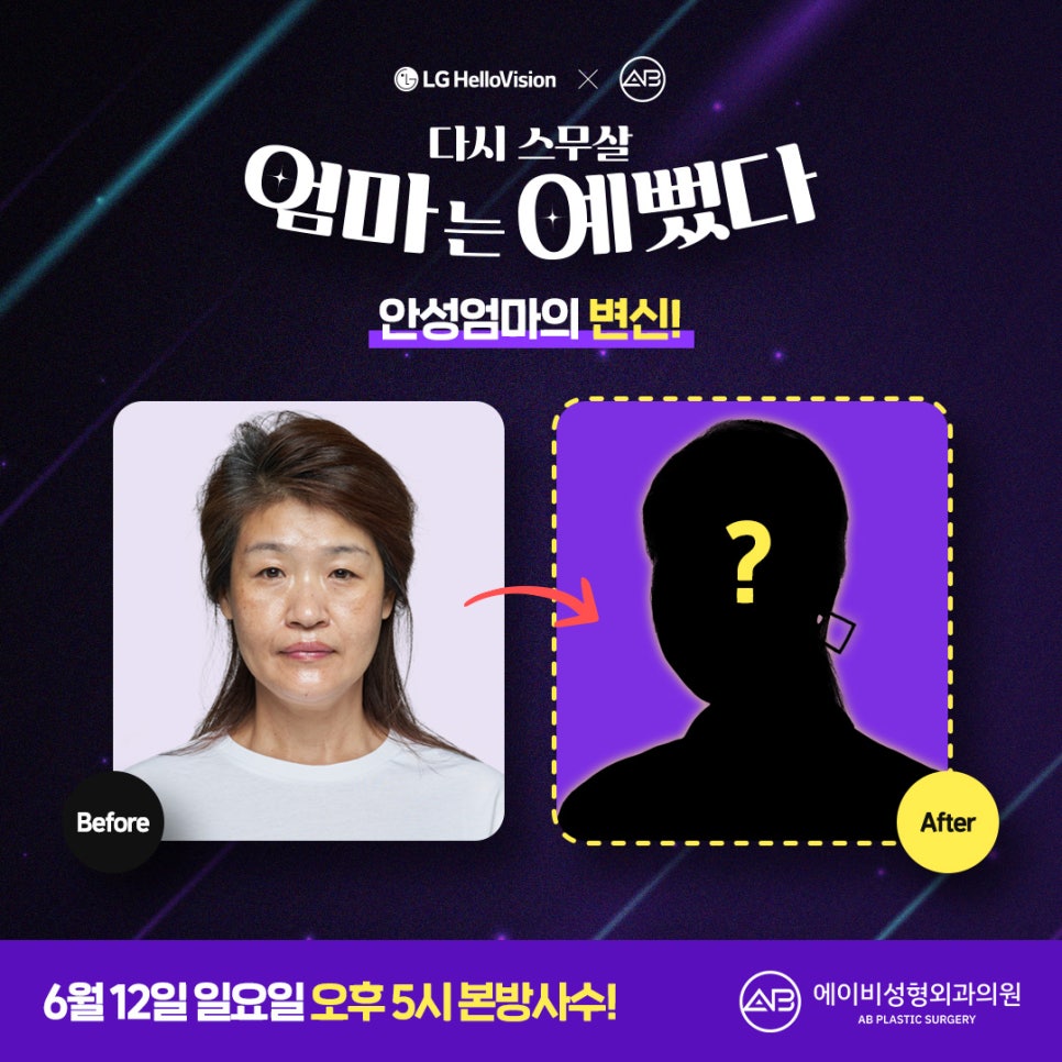 에이비성형외과 & 엄마는예뻤다 안성엄마의 변신! 관련 이미지 2