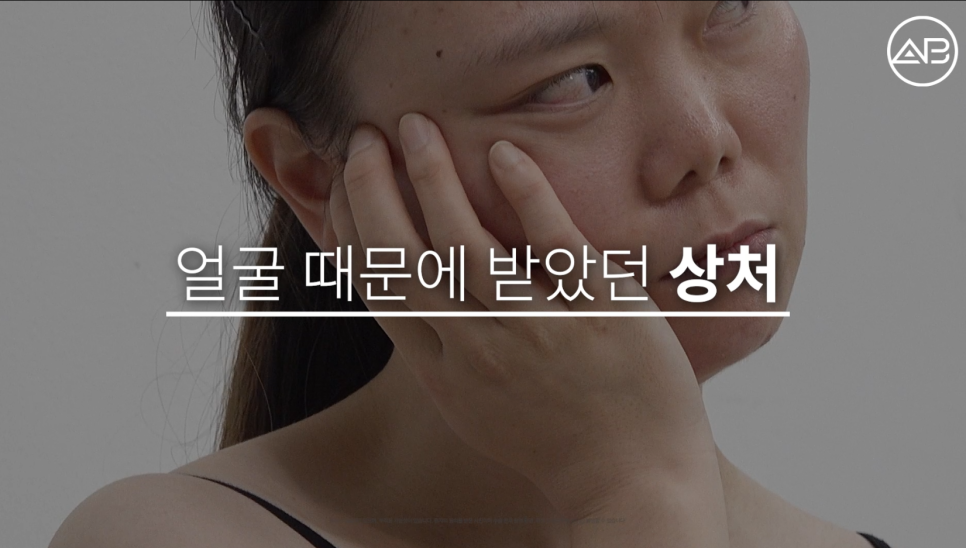 에이비성형외과 관련 이미지 4