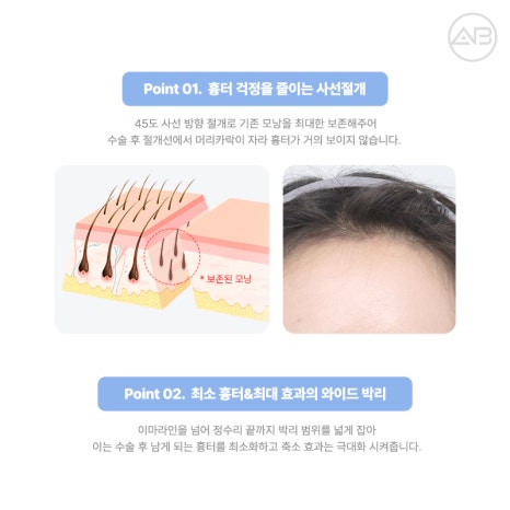 PRS KOREA 2024 : 에이비성형외과의 발표 내용과 성과 관련 이미지 8