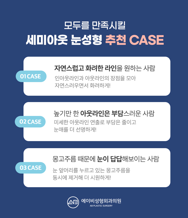 요즘 대세 세미아웃 눈성형 성공하려면? 관련 이미지 4