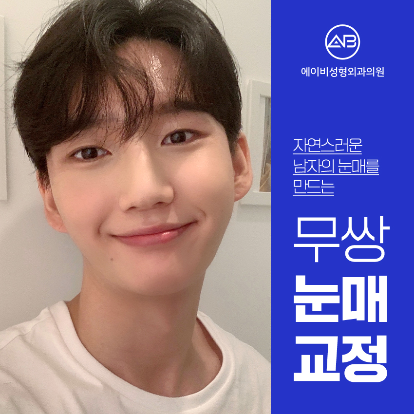 남자눈성형전후 차원이 달라 관련 이미지 2