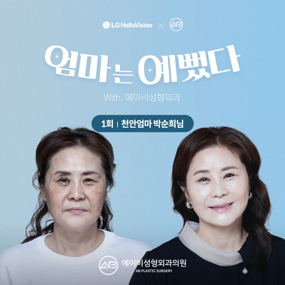 If It’s Midlife Eye Surgery Plastic Surgery, It Has to Be AB image 4