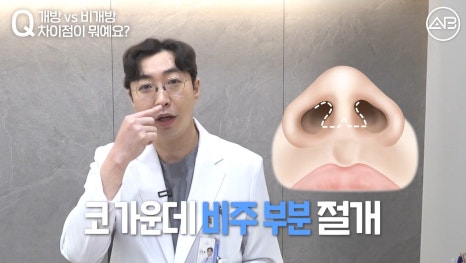 #AB Plastic Surgery #AB TV #Nose Surgery #First Nose Surgery image 6