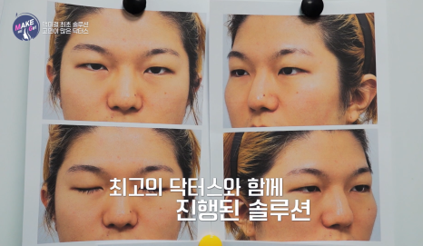 에이비성형외과 X 맥미걸(MAKEMEGirl) 9회 리얼맥미걸 방송리뷰 관련 이미지 6