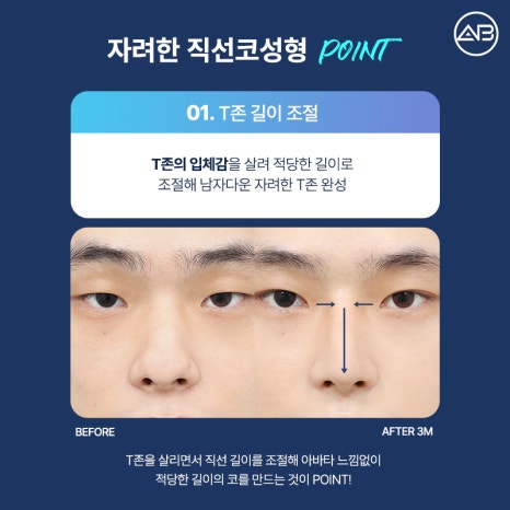 AB Plastic Surgery: What’s Different About an Elegant Male Straight Nose Surgery? image 5