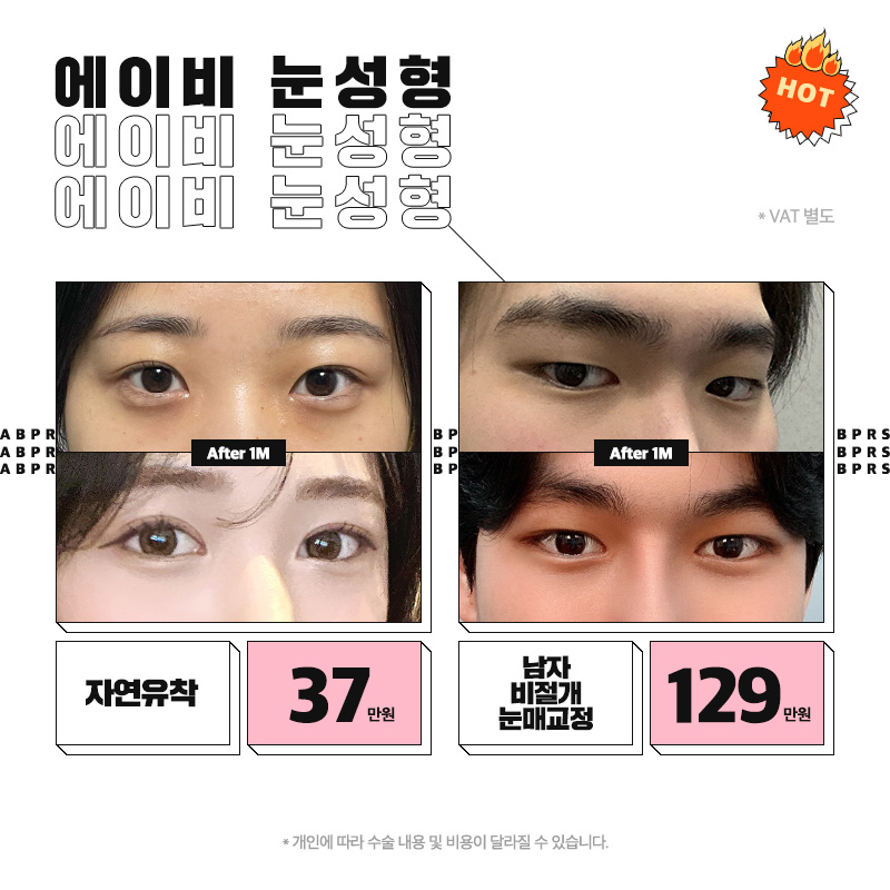에이비성형외과 확장이전 이벤트 안내 관련 이미지 2