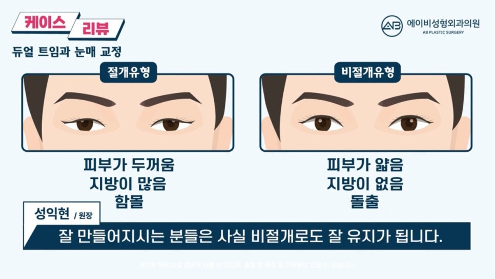 #에이비성형외과#에이비tv#눈성형#남자눈성형 관련 이미지 3