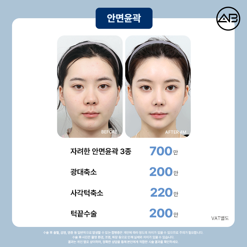 AB Plastic Surgery 49% Winter Limited Event image 11