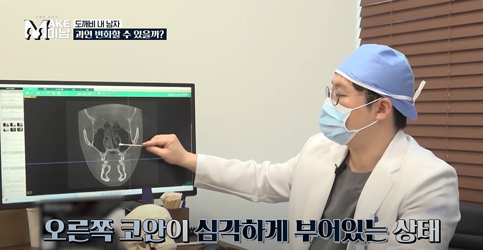 에이비성형외과 맥미남(MAKE미남) 4회 - 도깨비내남자 코수술 알아보기! 관련 이미지 3