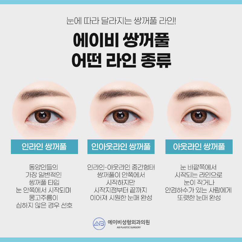 쌍꺼풀수술 자연유착 매몰법 VS 절개법 차이 관련 이미지 2