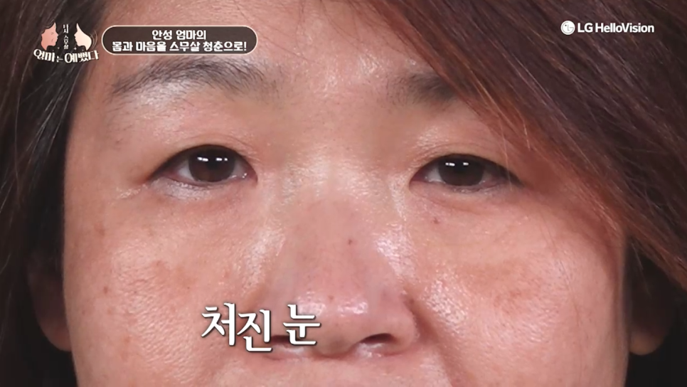[에이비성형외과 방송출연] 엄마는예뻤다 7회 안성엄마 전후모습 다시보기 관련 이미지 12