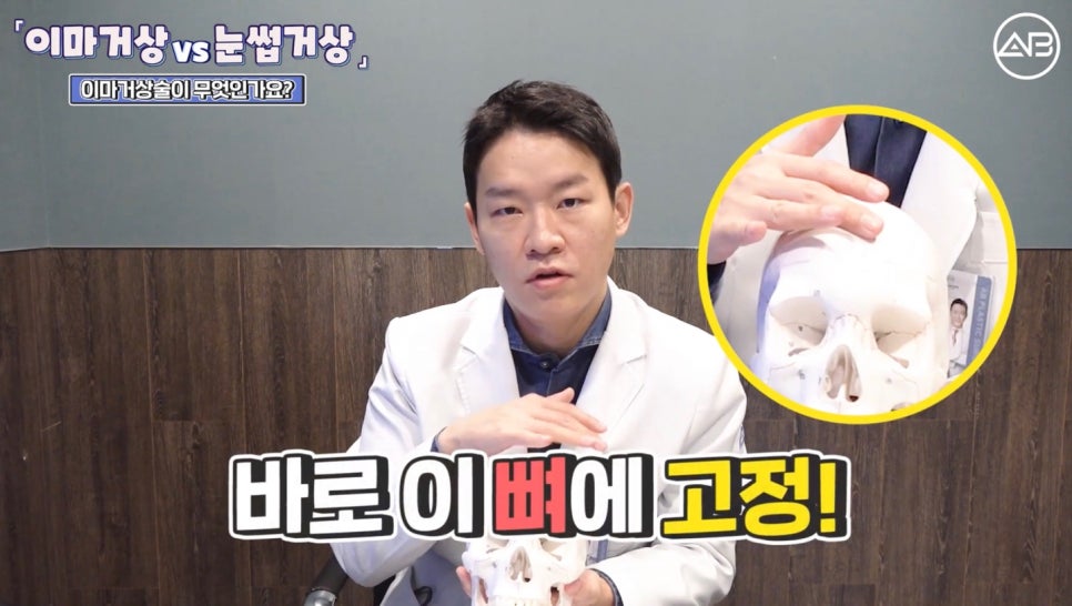 #AB Plastic Surgery #AB TV #Forehead Lift #Brow Lift image 2