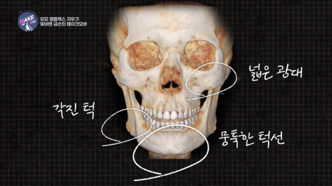 외모 비하를 이겨낸 그녀, 관련 이미지 5