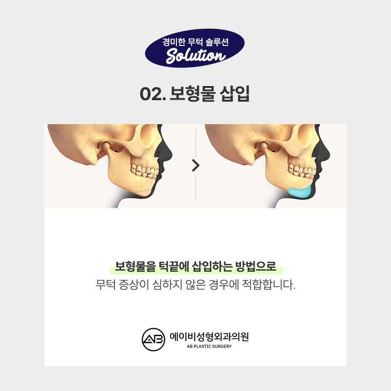AB Plastic Surgery with Many Facial Contouring Reviews image 7