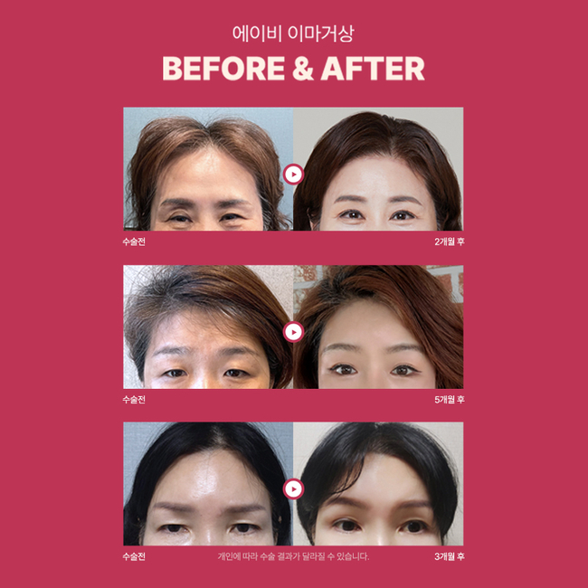 이마거상술가격 합리적으로 신중하게 선택하는 방법 관련 이미지 4