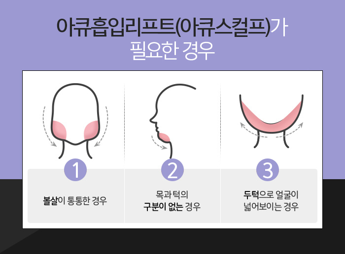 아큐스컬프부작용 걱정된다면 관련 이미지 5