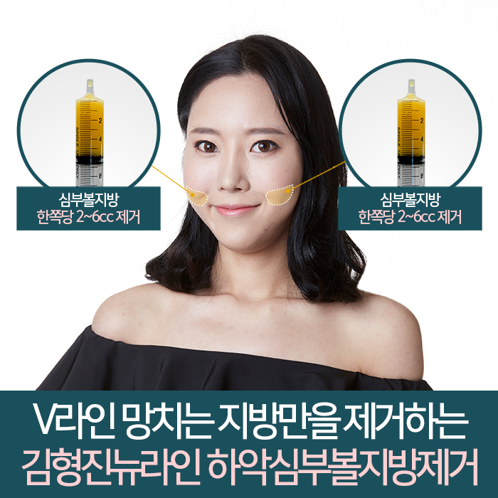 심부볼제거후기 진짜를 보여주지 관련 이미지 5