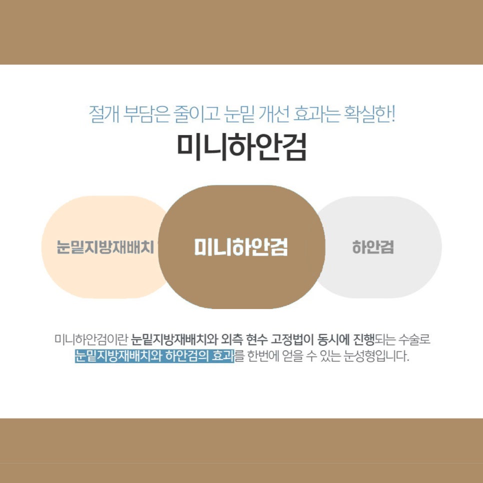 미니하안검은 반드시 중년눈성형잘하는곳에서 관련 이미지 4