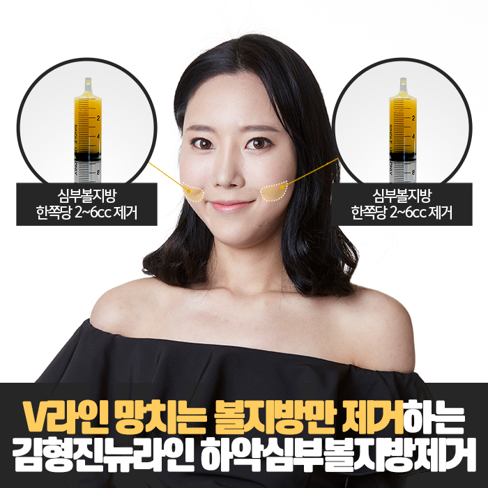 심부볼윤곽주사 누가 가능하대? 관련 이미지 4