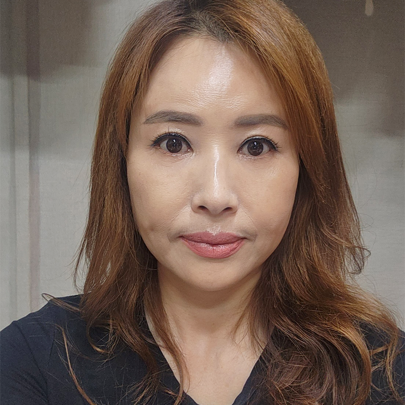 미니하안검효과 이렇게나 좋다구요! 관련 이미지 1