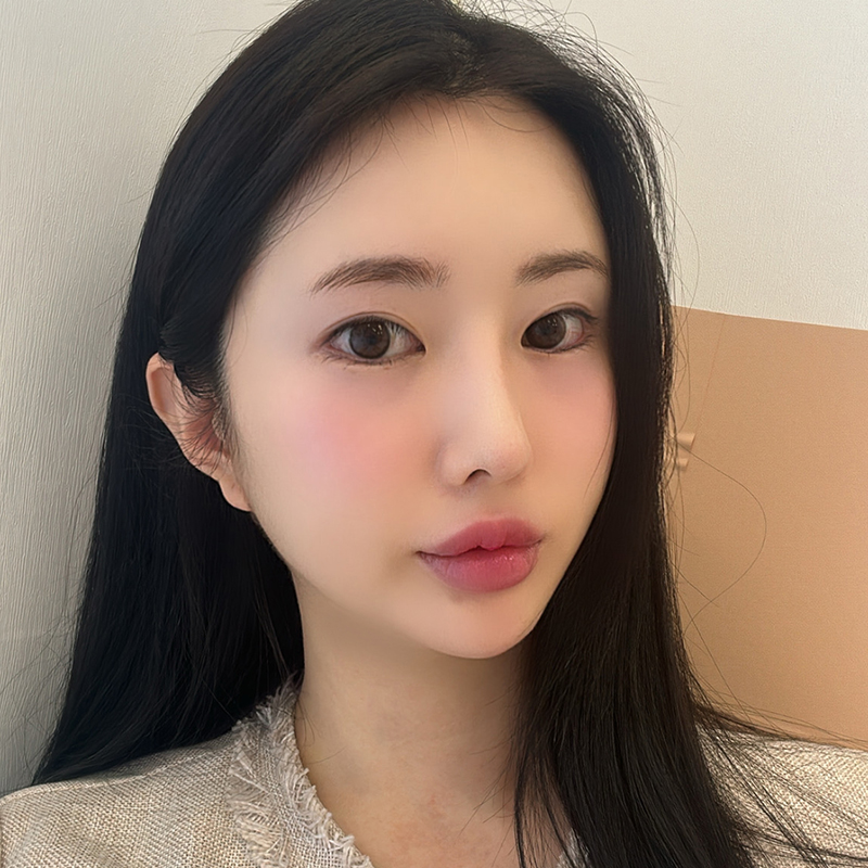 턱밑침샘보톡스효과 모르면 안돼죠 관련 이미지 4