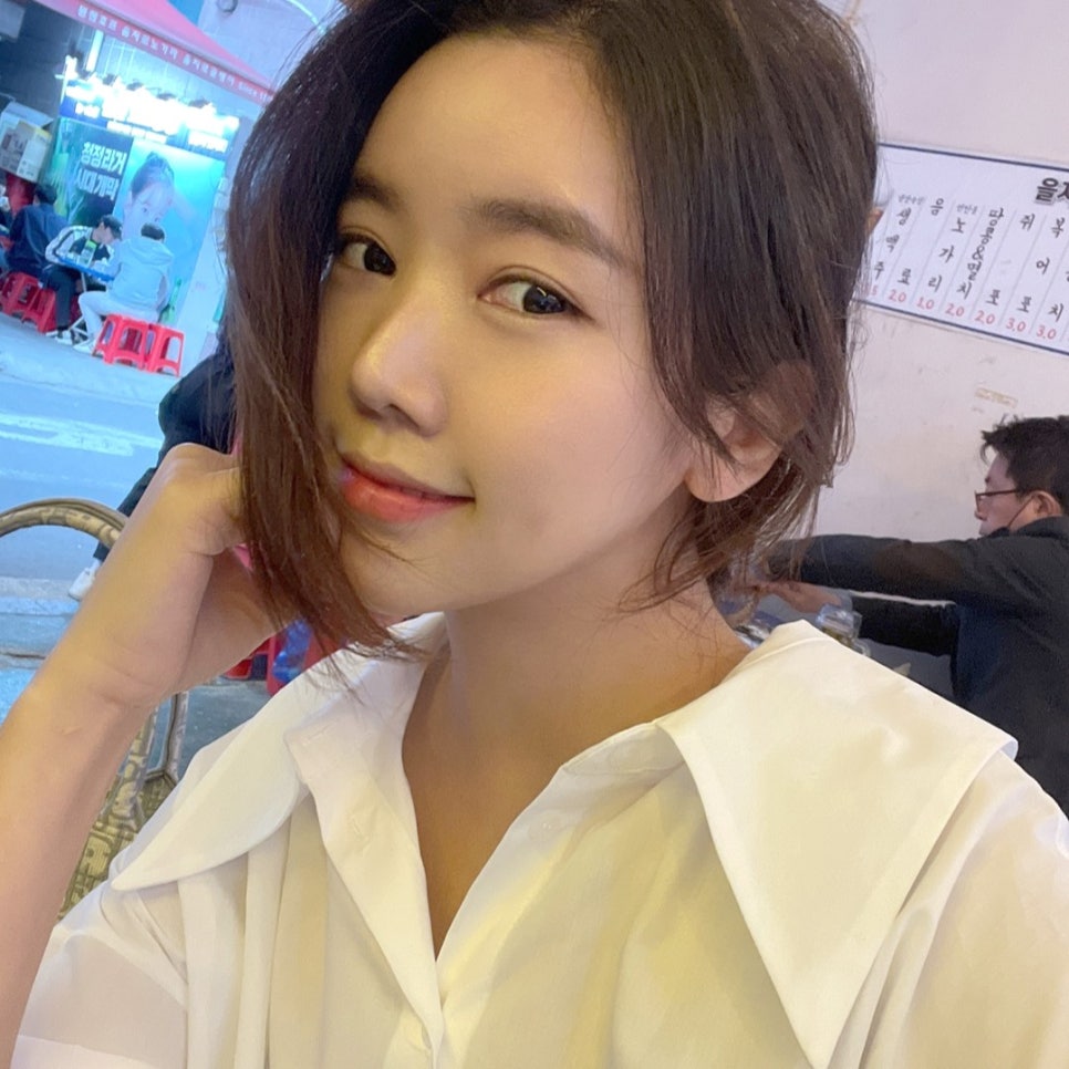 양악없이 빵떡 탈출한 얼굴지흡전후 관련 이미지 1