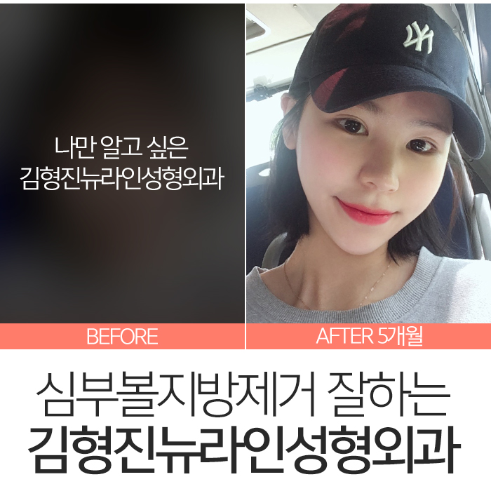 심부볼만 했어요 관련 이미지 2