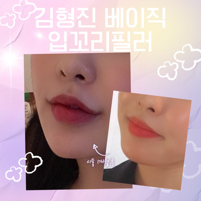 너무 쉽게 입꼬리올리는법 김형진베이직에서 알려드려요! 관련 이미지 6