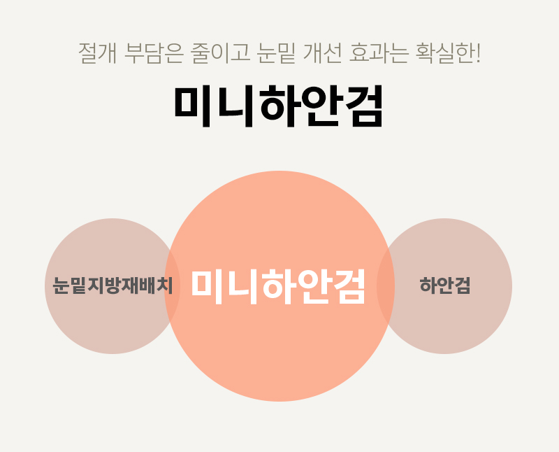 미니하안검 너무 괜찮죠? 관련 이미지 2
