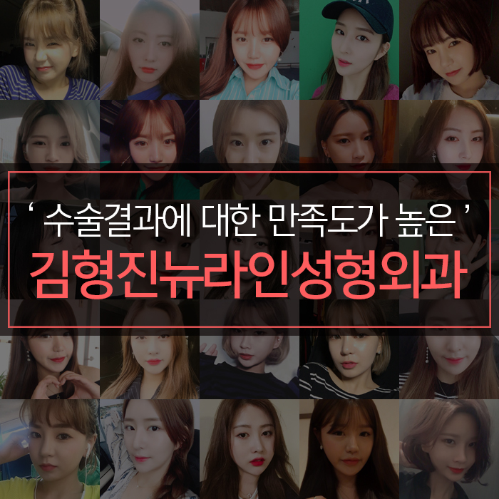 옆광대지방흡입 확실한건 아큐리프트다! 관련 이미지 7