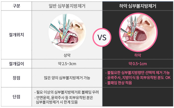 땅콩형얼굴 고민만 하고 있나요? 관련 이미지 6