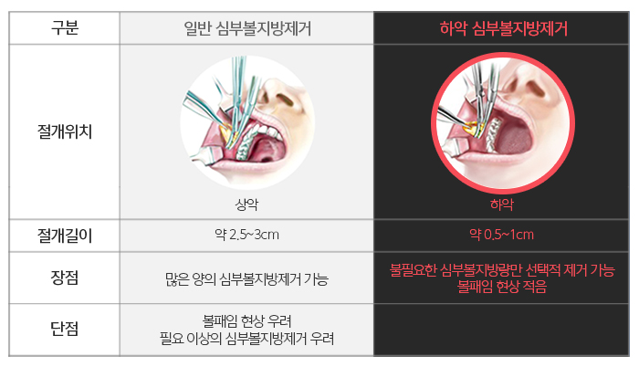 심부볼가격 아직도 싼 곳만 찾아요? 관련 이미지 5