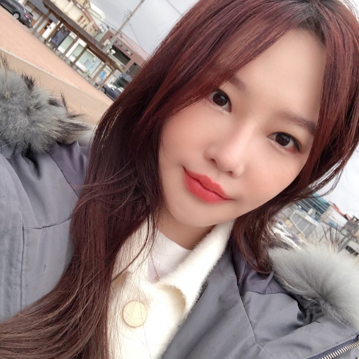 입꼬리필러전후 보고 여기로 마음 굳혔어요! 관련 이미지 1