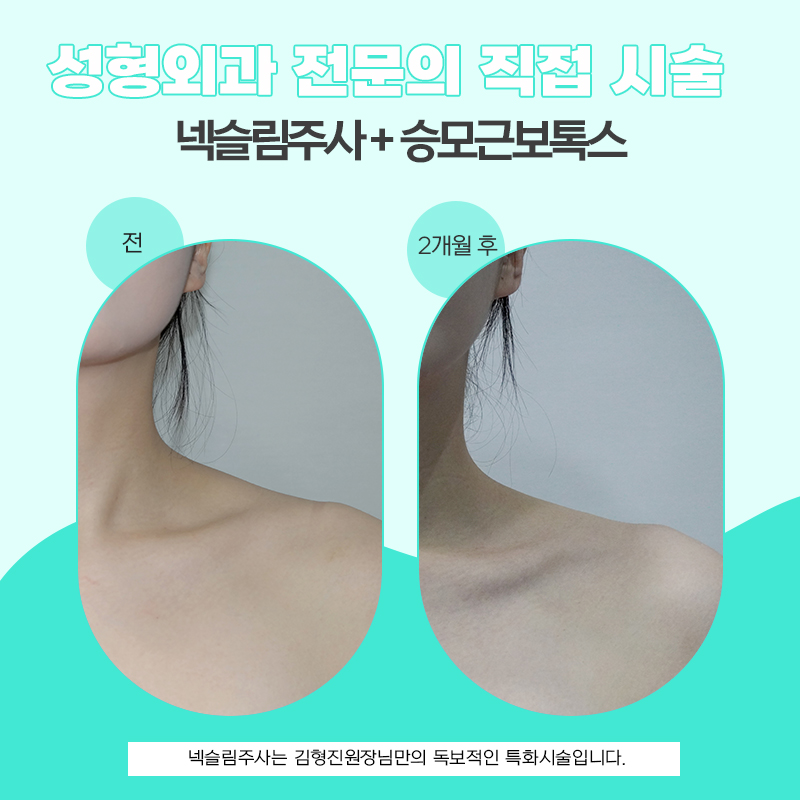 넥슬림주사효과 원조는 다르네요... 관련 이미지 6