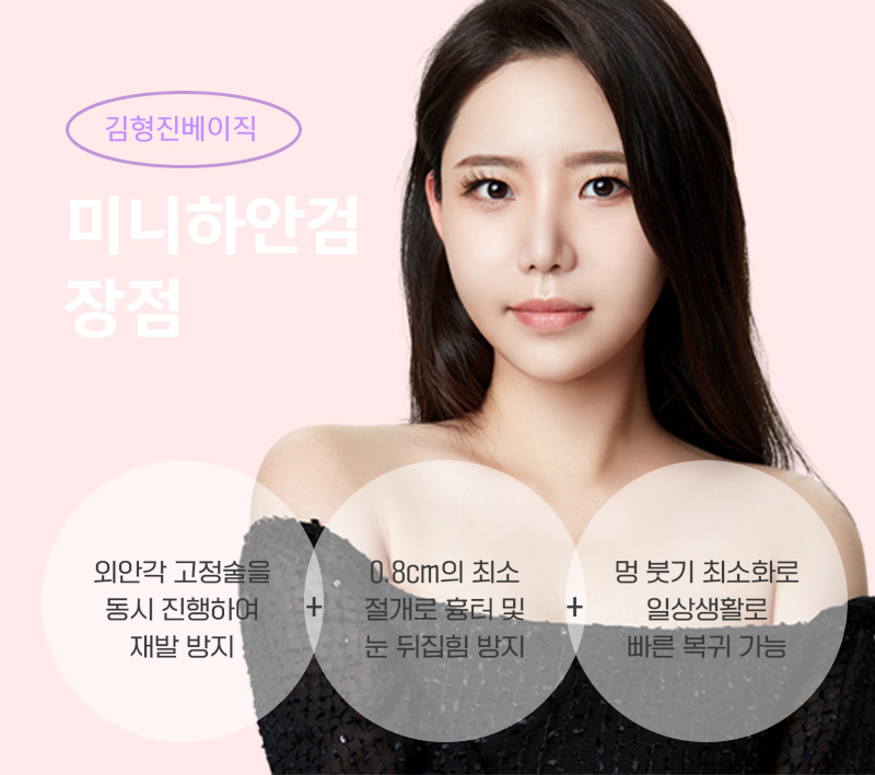 미니하안검흉터 걱정하지마세요! 관련 이미지 3