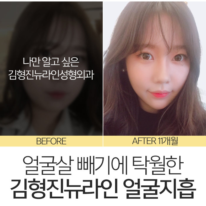 얼굴살빼는법 이렇게나 쉽다니 관련 이미지 2