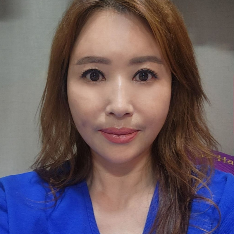 중년눈밑처짐 해결법은 단 한 가지 관련 이미지 2