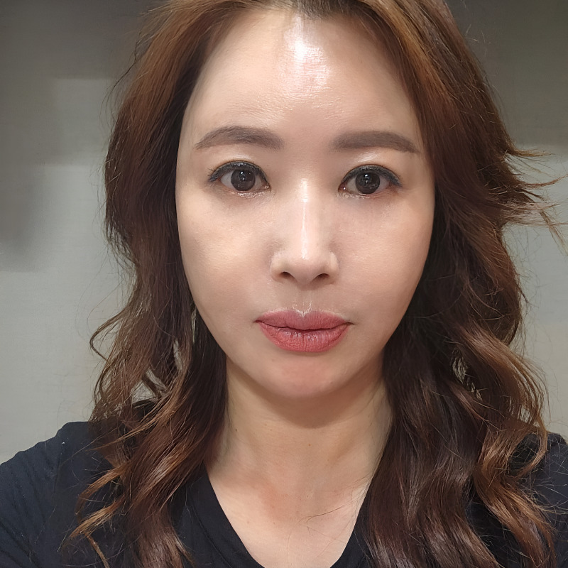 요즘 중년눈밑처짐수술 만족도 1위로 등극한 미니하안검?! 관련 이미지 2