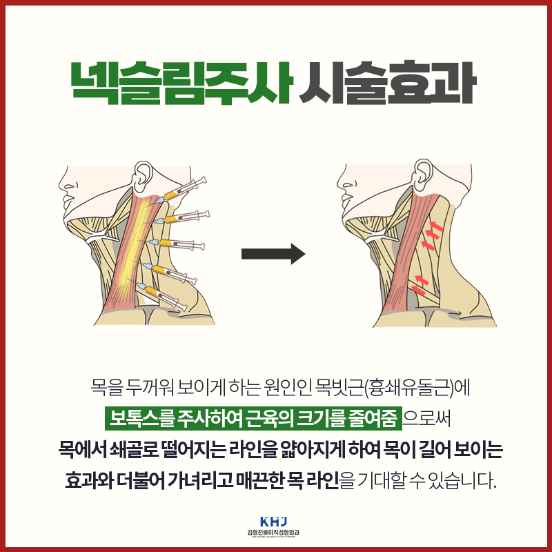 목과 어깨라인을 정리하는 웨딩관리가 필요할 때 관련 이미지 3
