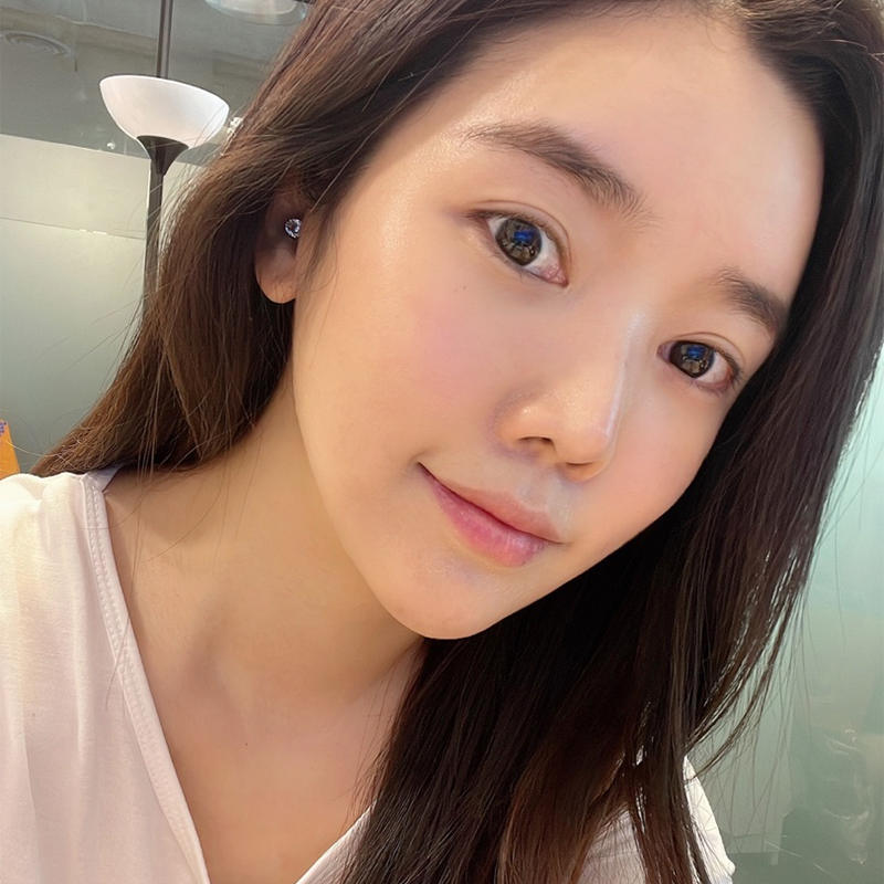 압구정눈밑지방재배치 여기예요~! 관련 이미지 2