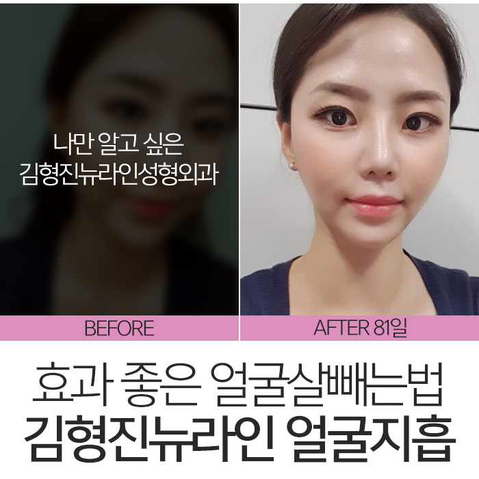 얼굴살빼는법 알아보고 있었다면? 관련 이미지 3
