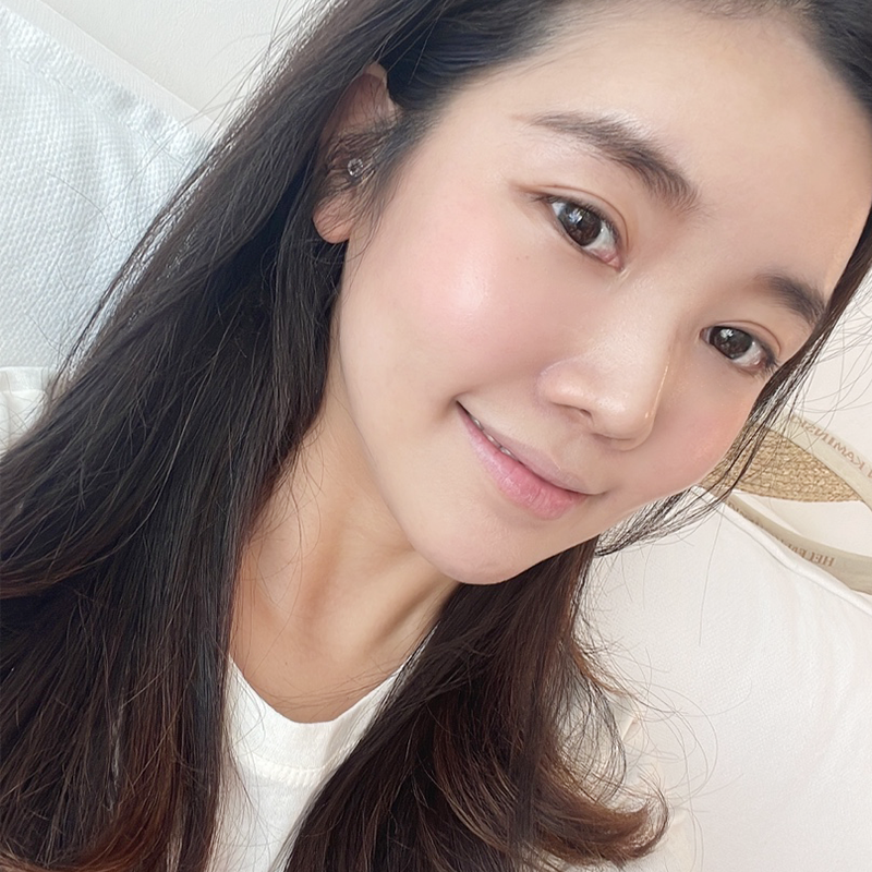 눈밑지방재배치재발 걱정되셨다구요? 관련 이미지 3