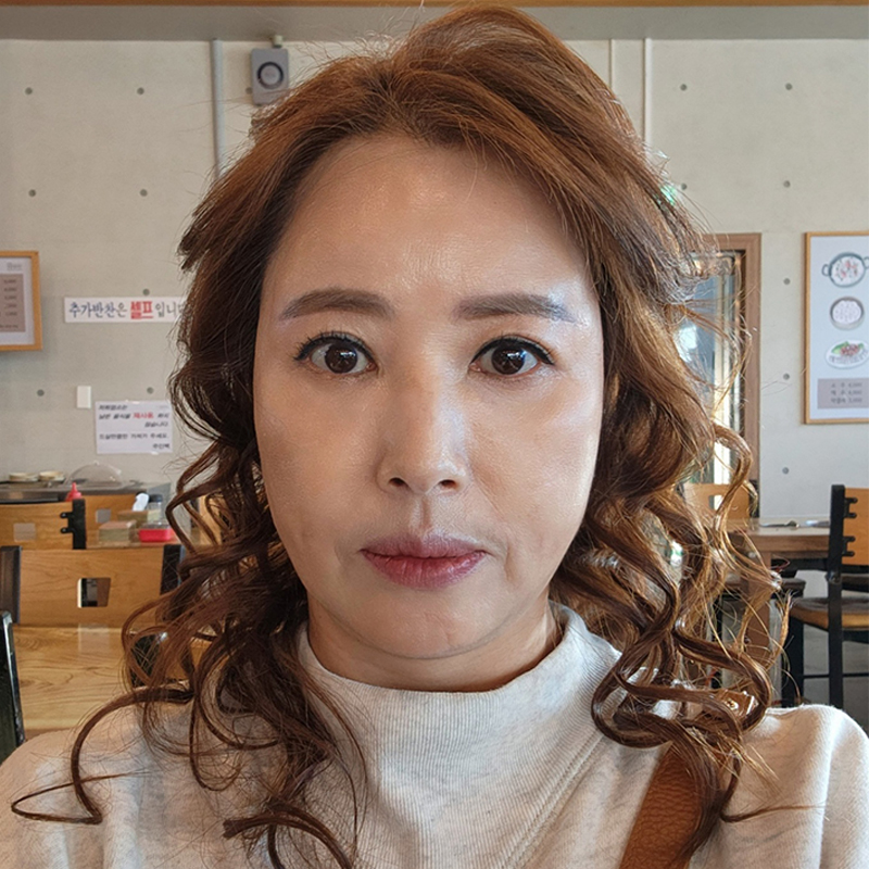 중년눈밑지방수술 아직 모르신다면 관련 이미지 1