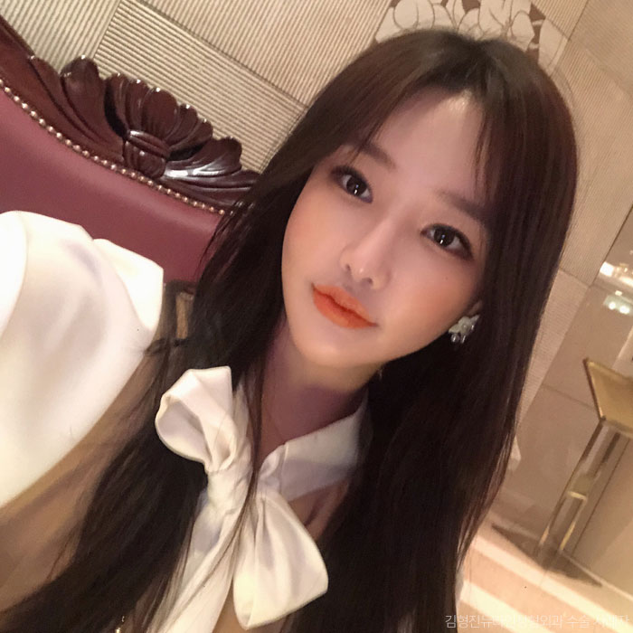 하악심부볼지방제거 잘하는곳에서 해야죠 관련 이미지 1