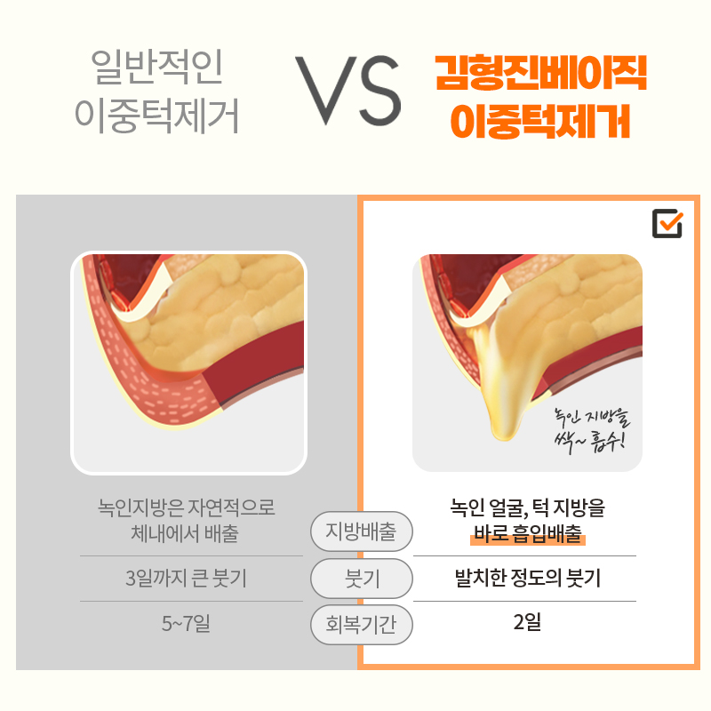 턱살빼는법 저만 알고 싶었는데 그냥 공개할게요 관련 이미지 7