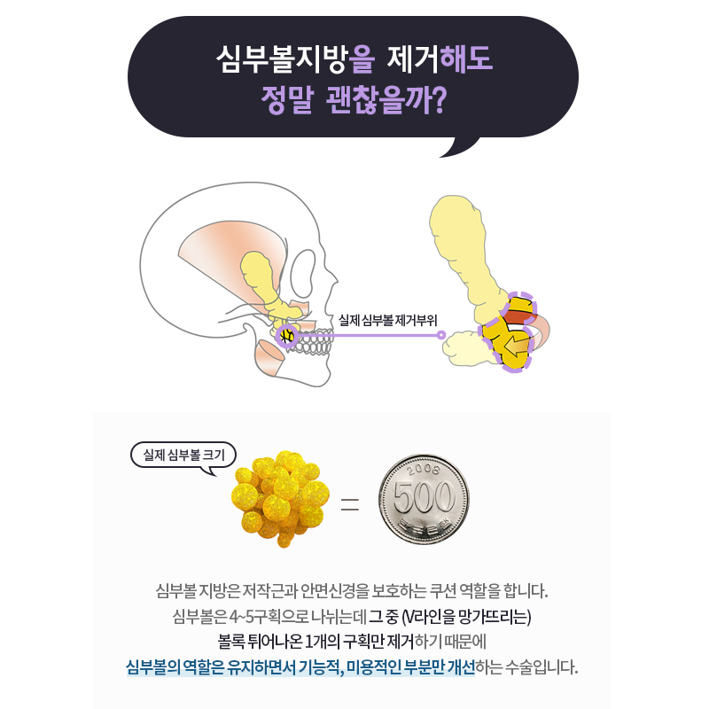얼굴지흡후기 더이상 볼 필요 없네요 관련 이미지 5