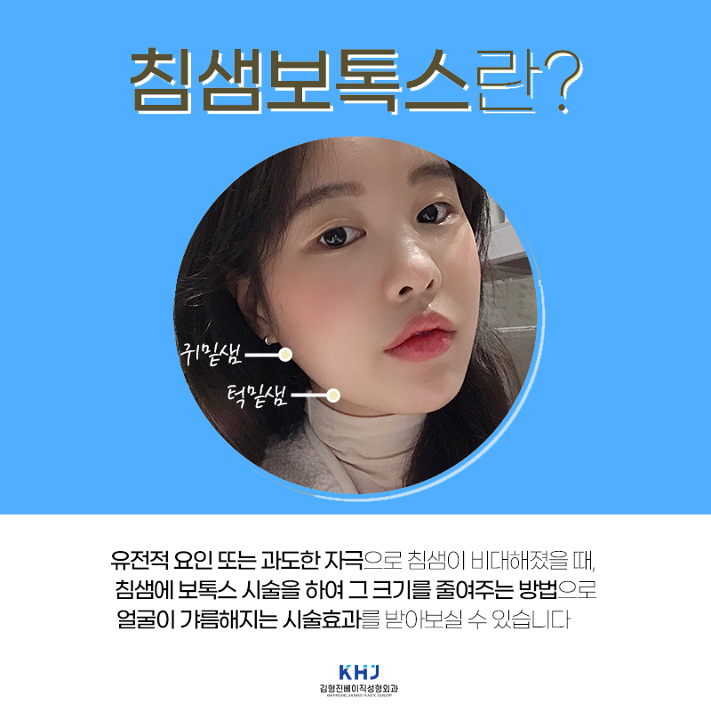 강남침샘보톡스 살을 빼도 턱선을 찾을 수 없다면? 관련 이미지 4