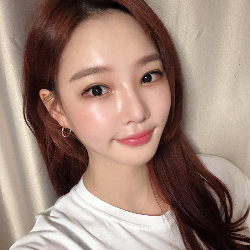 눈밑지방재배치재발 걱정되셨다구요? 관련 이미지 6