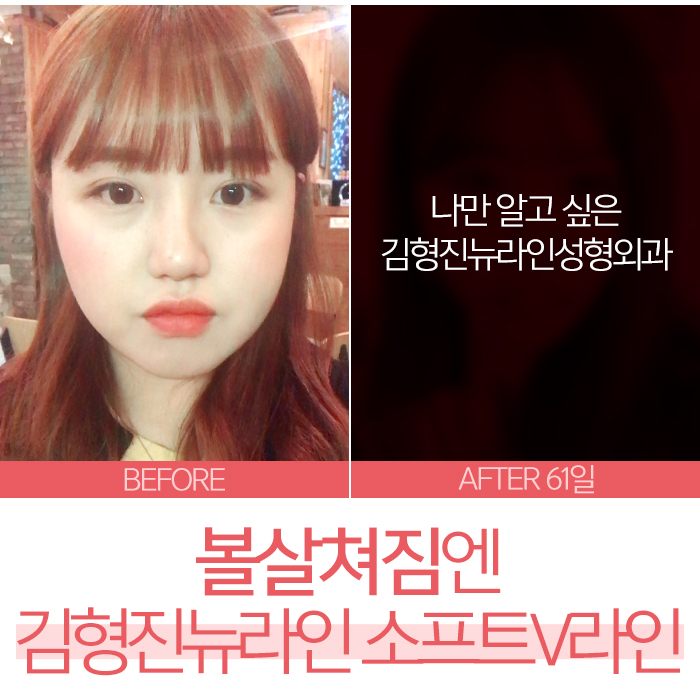 볼살쳐짐 어이 하늬? 관련 이미지 6
