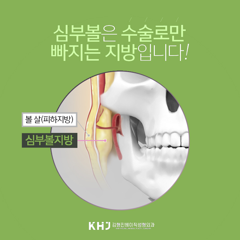 불독살제거,단순한 다이어트로는 어려운 이유 알고 계신가요? 관련 이미지 4